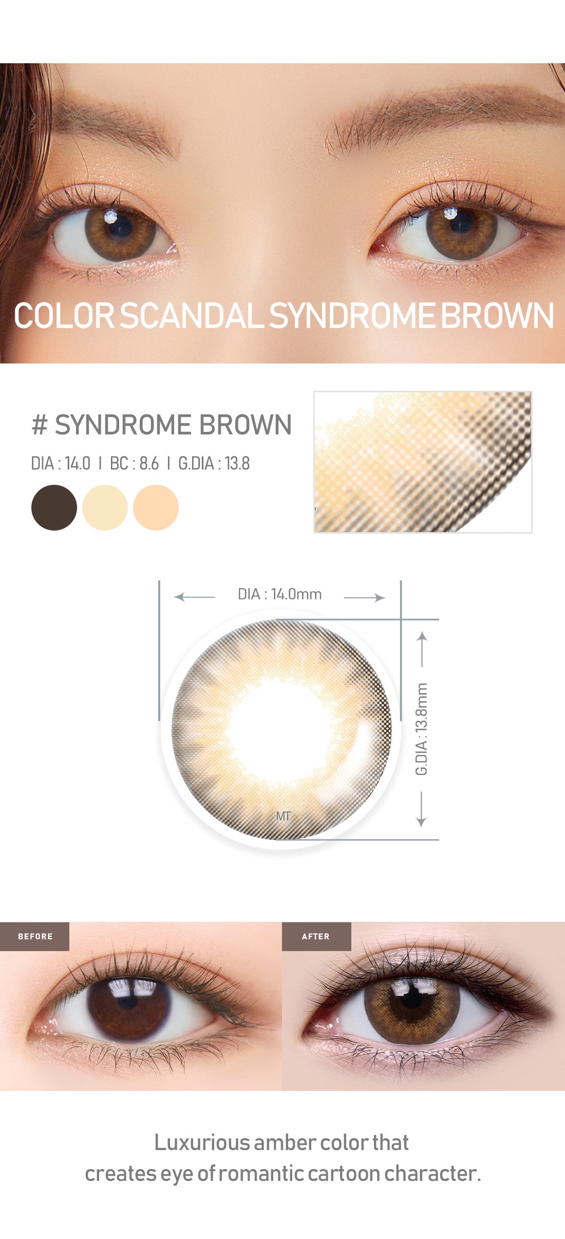 [Select Period] Torica Syndrome Brown