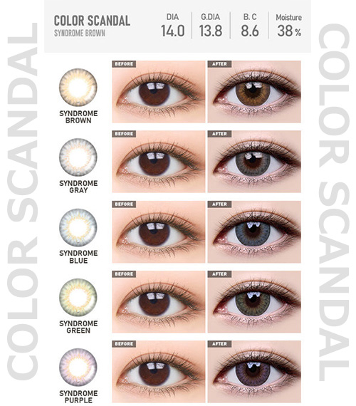 [Select Period] Torica Syndrome Brown