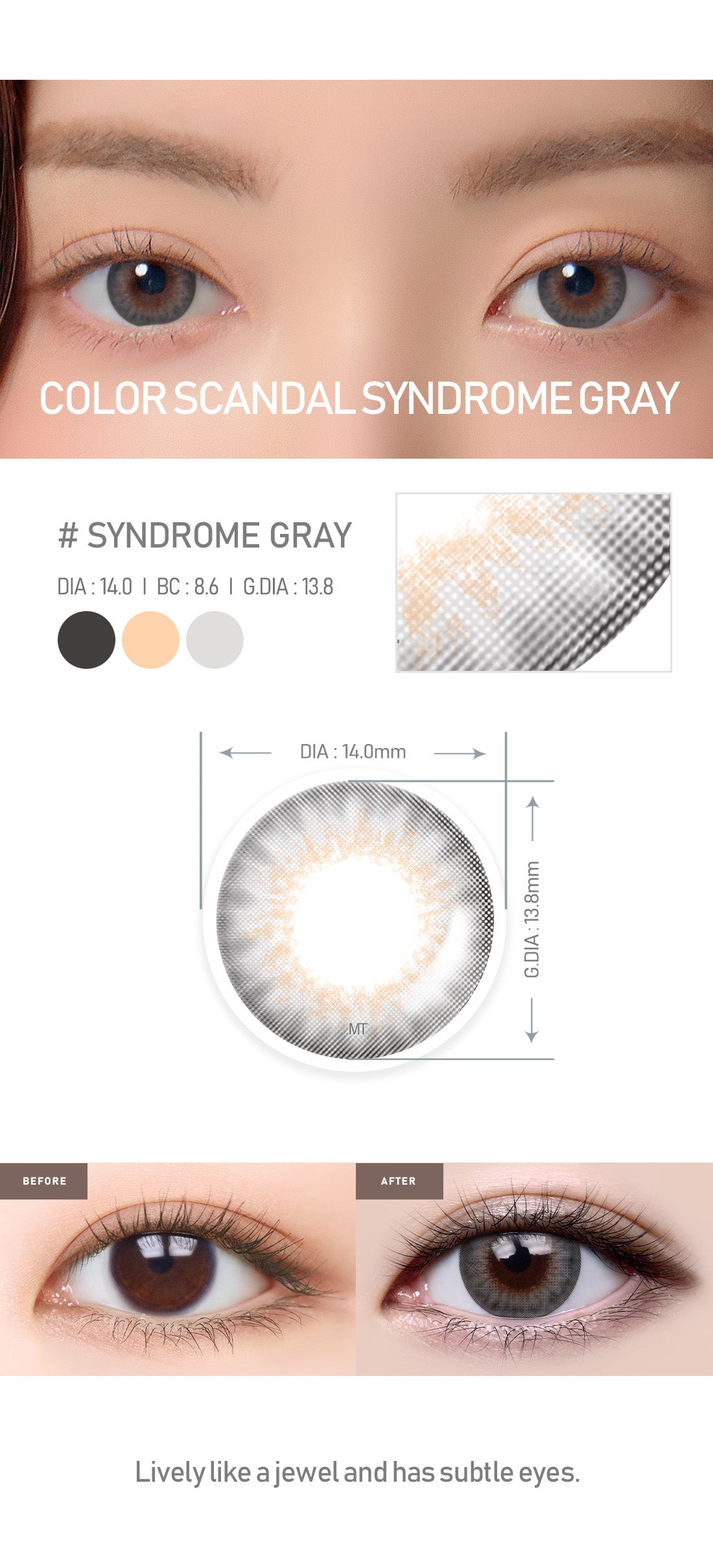[Select Period] Torica Syndrome Gray