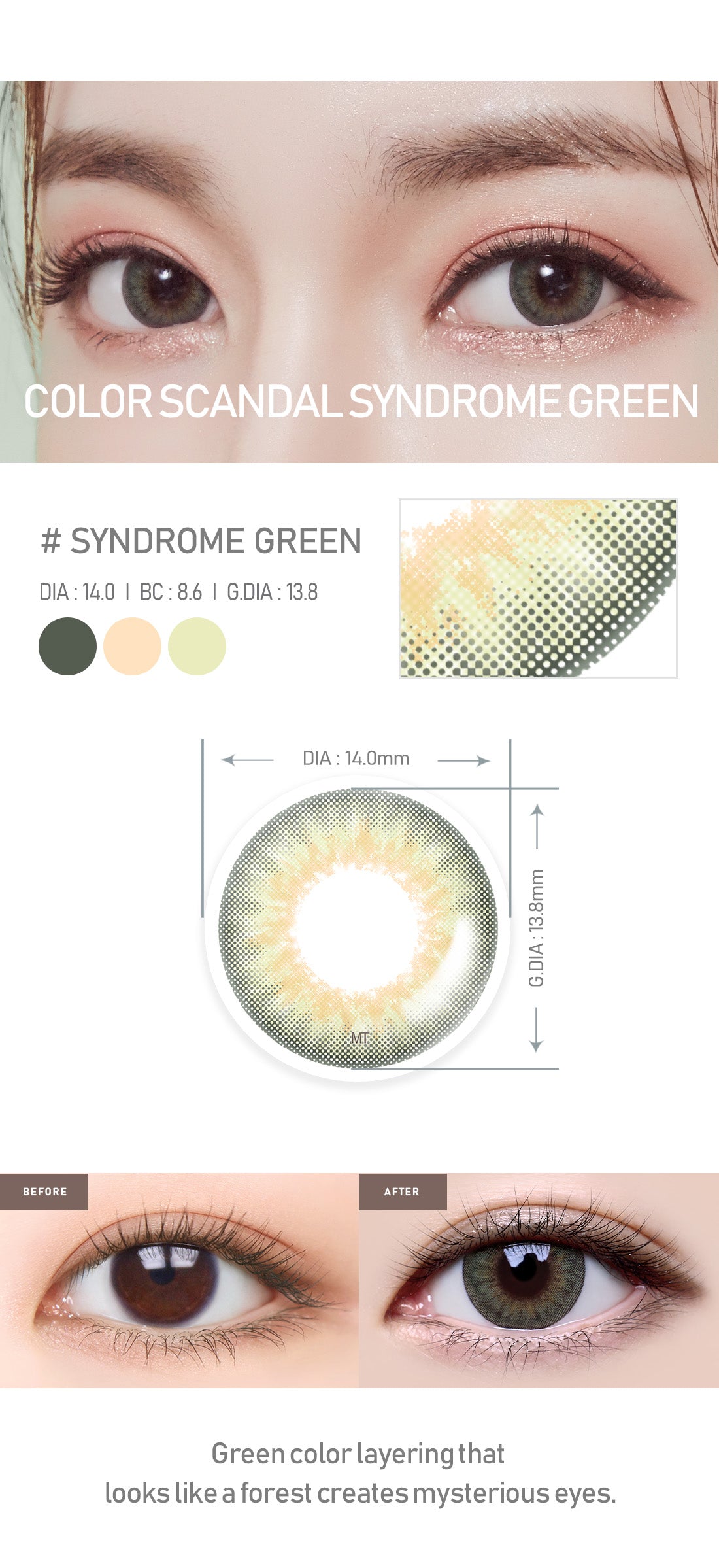 [Toric/Select Period] Torica Syndrome Green