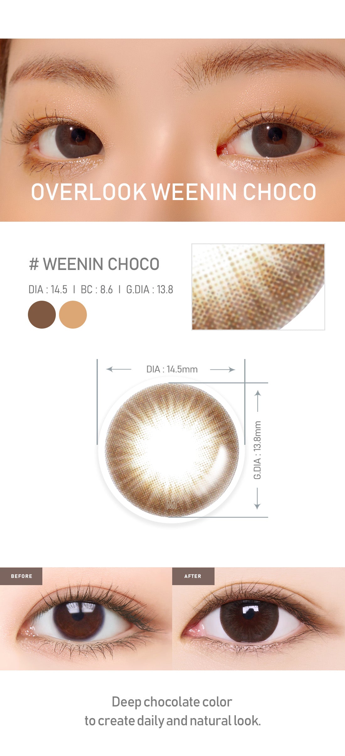 [Toric/Select Period] Torica Weenin Choco